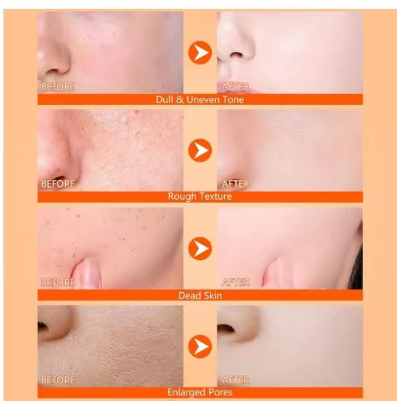 Exfoliating Kojic Acid & Turmeric Spray – 400 ml (Pack of 2) for Brighter Skin