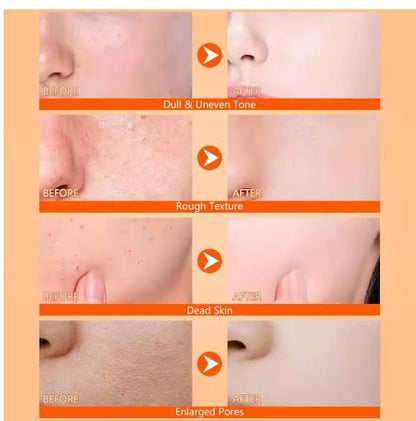 Exfoliating Kojic Acid & Turmeric Spray – 400 ml (Pack of 2) for Brighter Skin